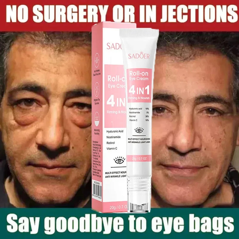 Anti-Wrinkle Retinol Eye Cream for Dark Circles and Puffiness