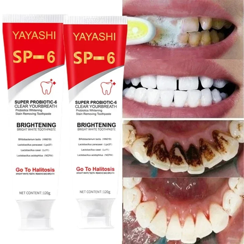 Probiotic Teeth Whitening Toothpaste for Stain Removal - 1
