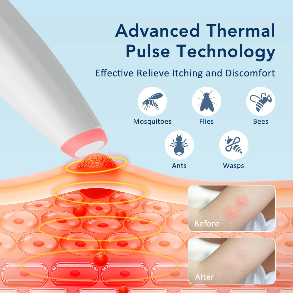 Electronic Insect Bite Itch Relief Pen - 5