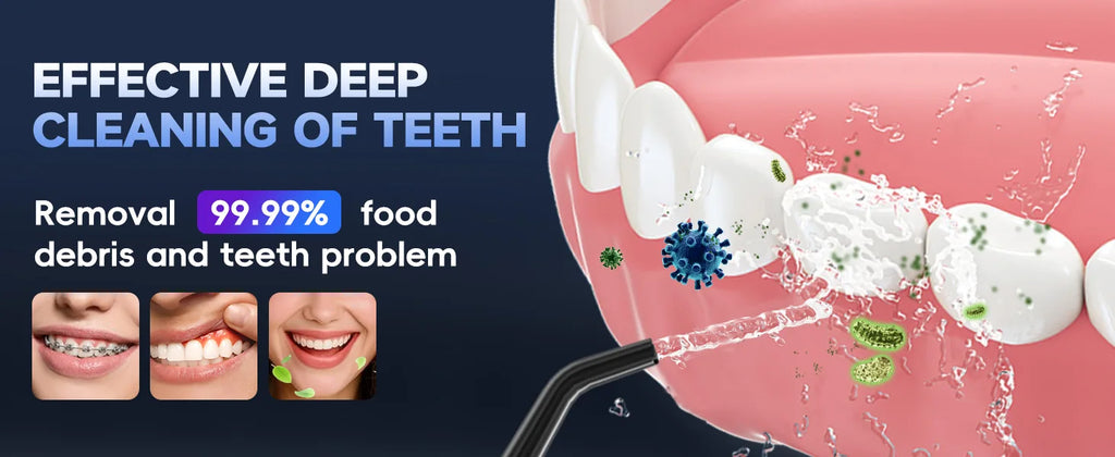 Portable Cordless Water Flosser for Teeth and Gum Health