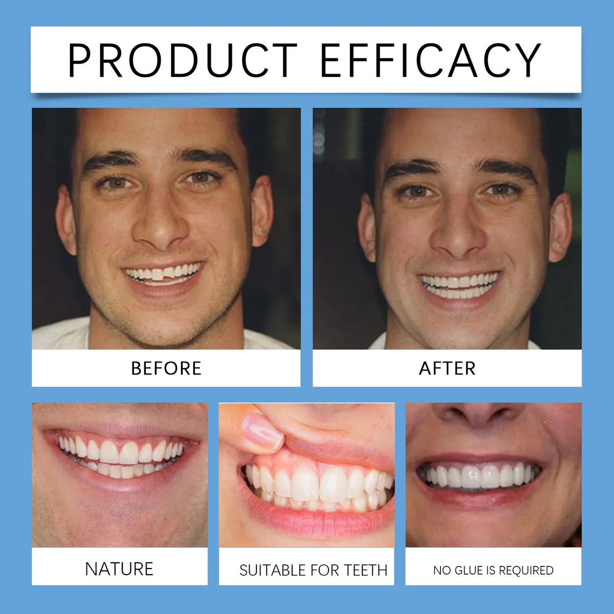 Adjustable Snap-On Dentures for Missing Teeth and Smile Correction