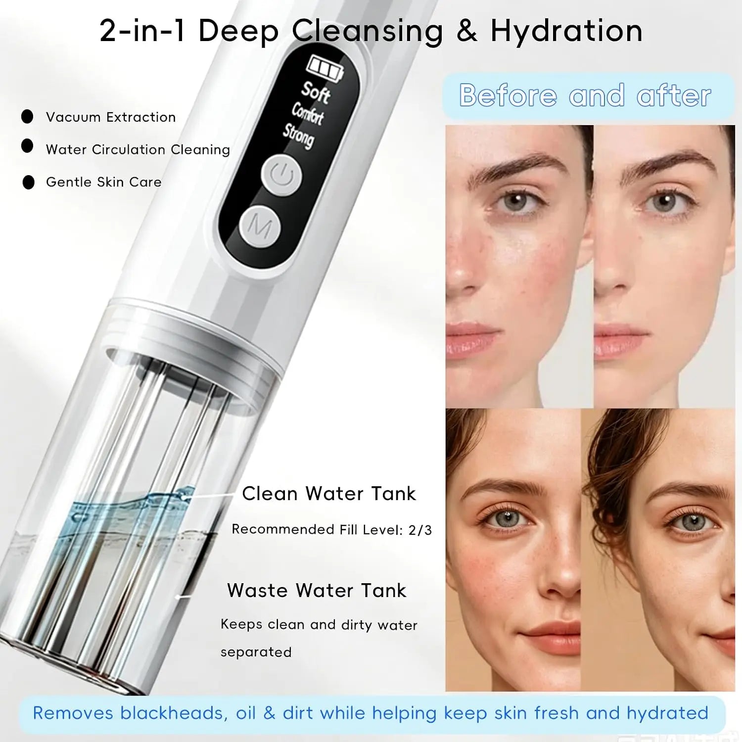 Hydrating Pore Vacuum Blackhead Remover with 6 Suction Heads - 2