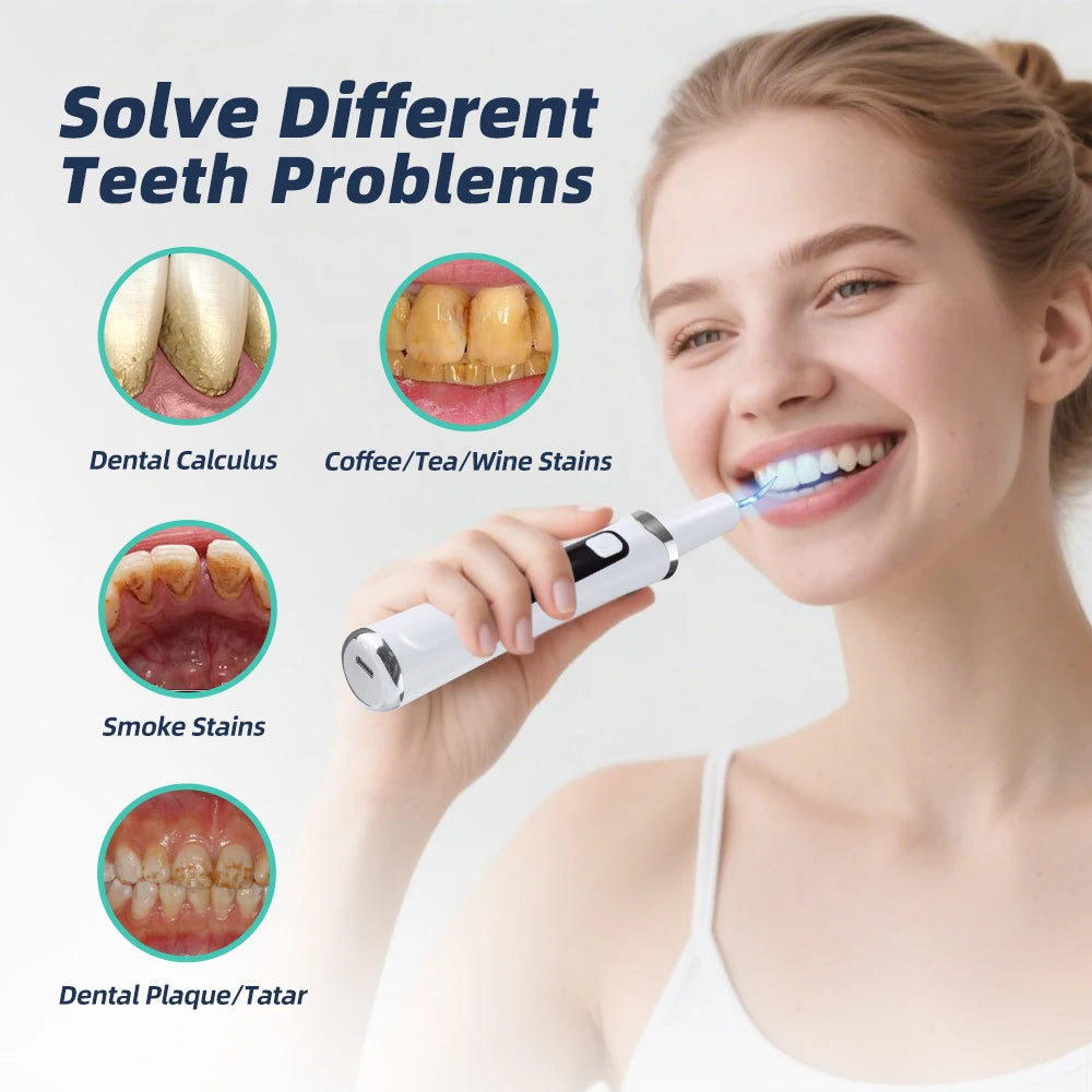 Ultrasonic Electric Dental Tartar and Plaque Remover