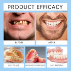 Temporary Snap-On Silicone Denture Set for Smile Whitening