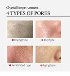 Salicylic Acid Pore Refining Cream for Acne and Blackheads