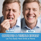 Instant Comfort Fit Silicone Denture Set for Natural Smile