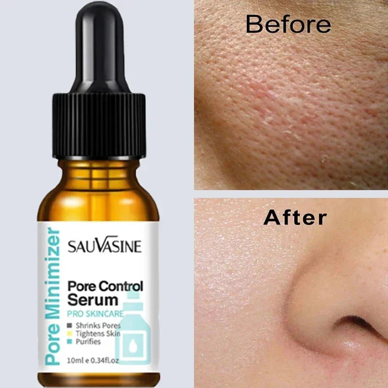 Pore Minimizing Facial Serum for Tightening and Smooth Skin - 1