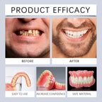 Flexible Silicone Denture Reline and Cosmetic Smile Kit