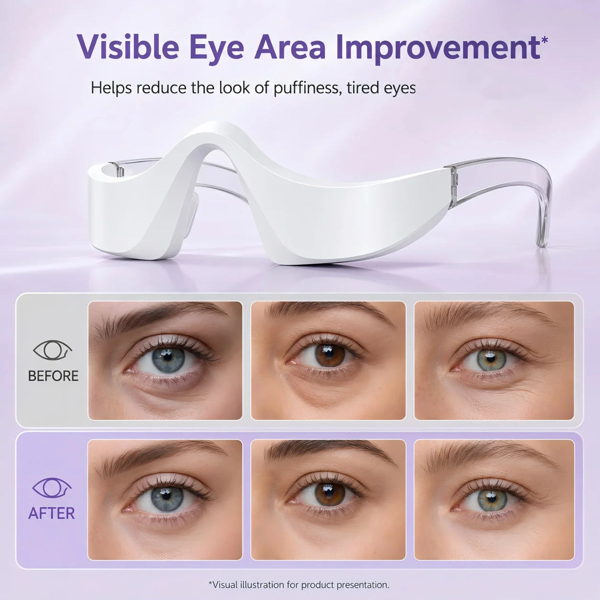 Red Light LED Eye Massager for Puffiness and Dark Circles