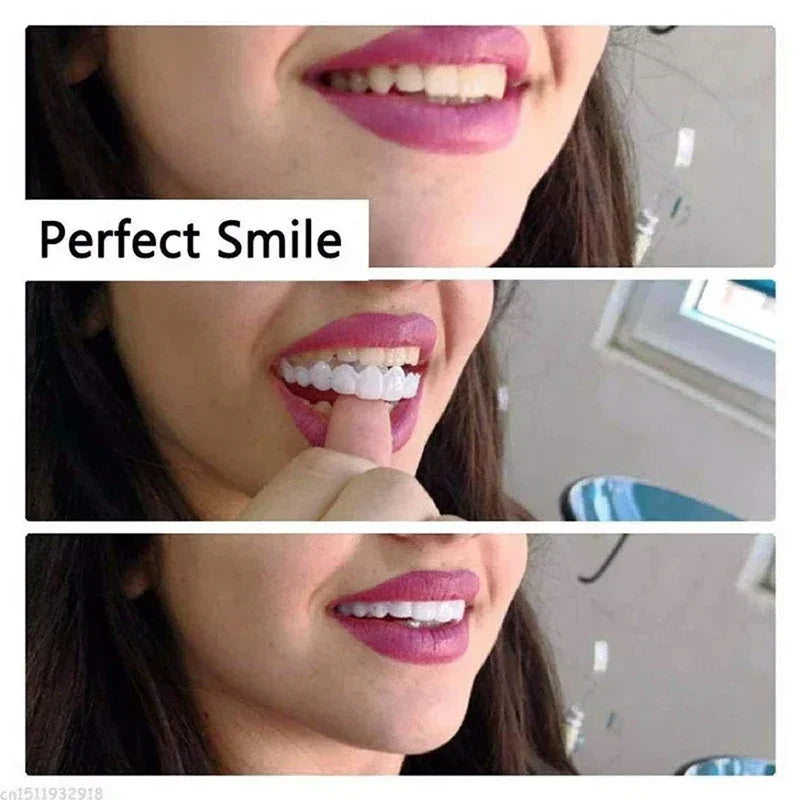 Snap-On Temporary Cosmetic Teeth Veneers