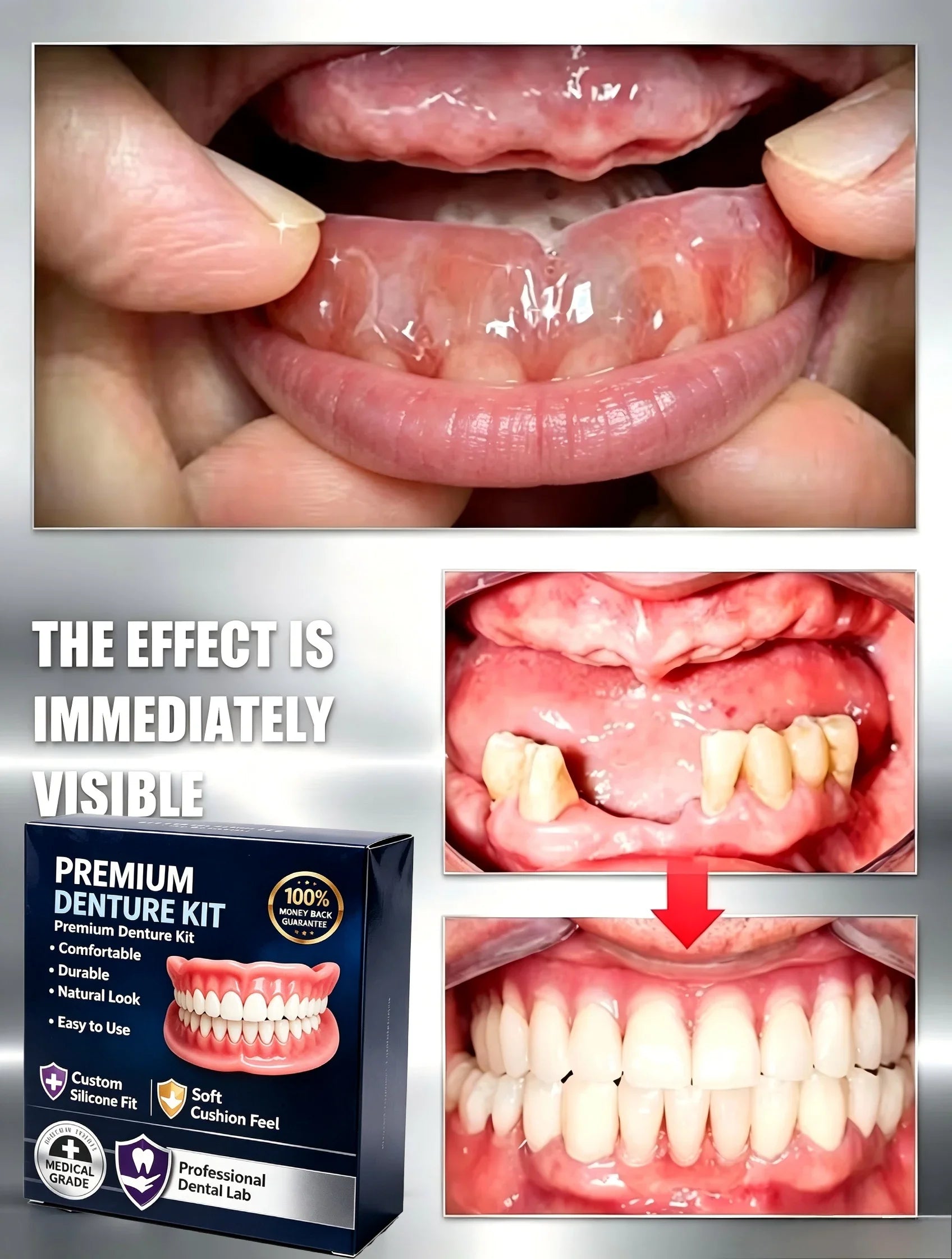 Temporary Silicone Cosmetic Denture Kit for Natural Smile - 9