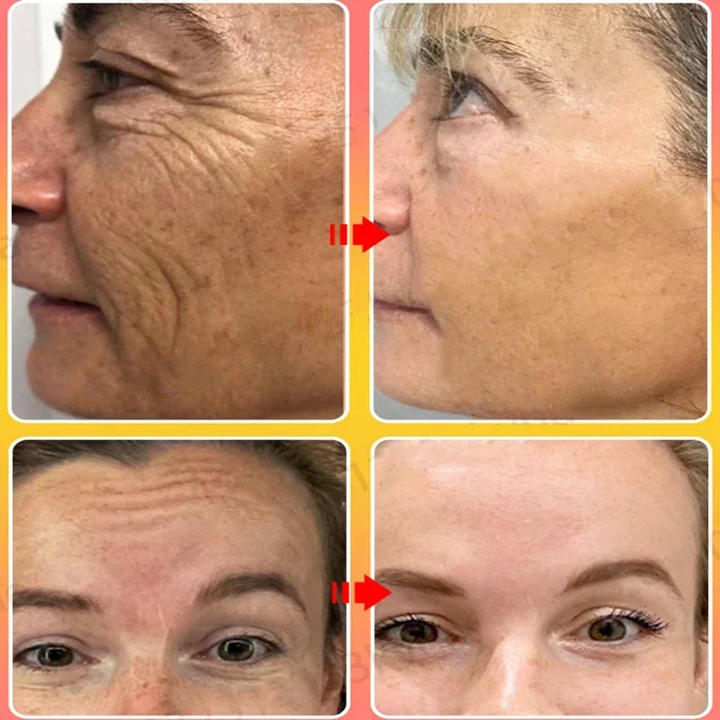 Anti-Wrinkle Moisturizing Face Cream for Firming and Lifting