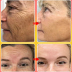Anti-Wrinkle Moisturizing Face Cream for Firming and Lifting