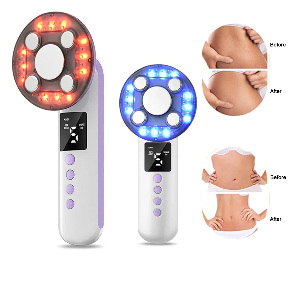 3-in-1 Ultrasonic EMS Body Slimming and Skin Tightening Massager