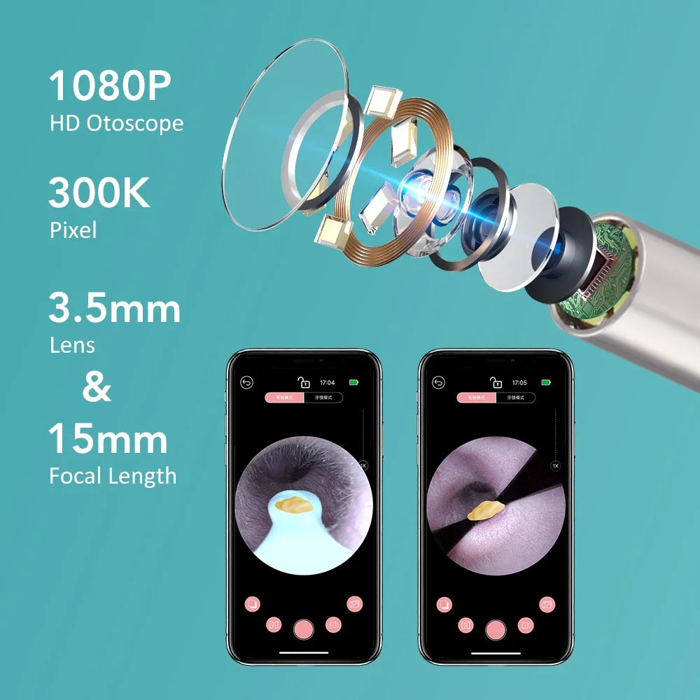 Visual Ear Wax Removal Tool with HD Camera - 3
