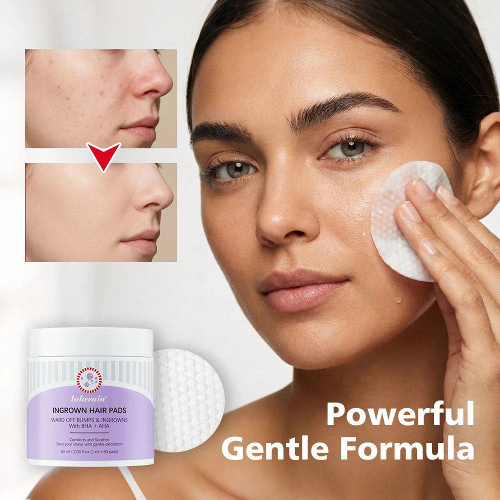 Ingrown Hair Treatment Pads for Razor Bumps and Exfoliation