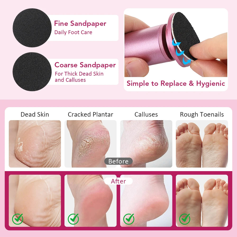 Electric Callus Remover for Pedicure and Smooth Heels
