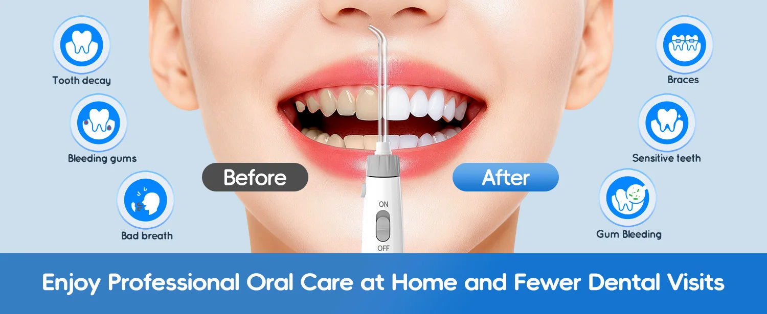 Electric Water Flosser with 8 Nozzles for Deep Oral Cleaning - 8