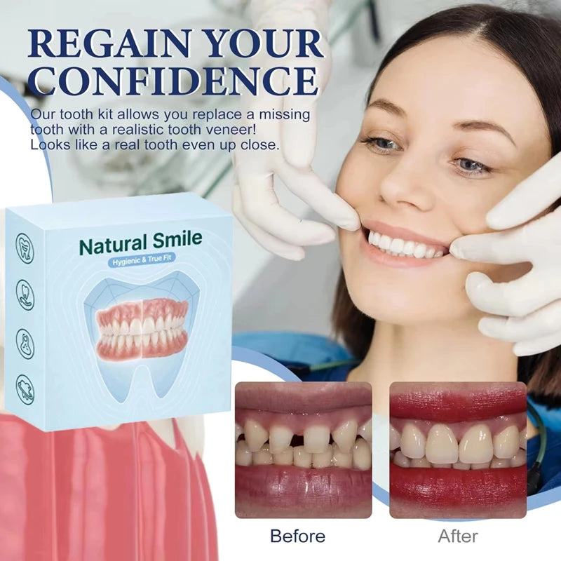 Silicone Cosmetic Dentures for Instant Smile Enhancement - 1