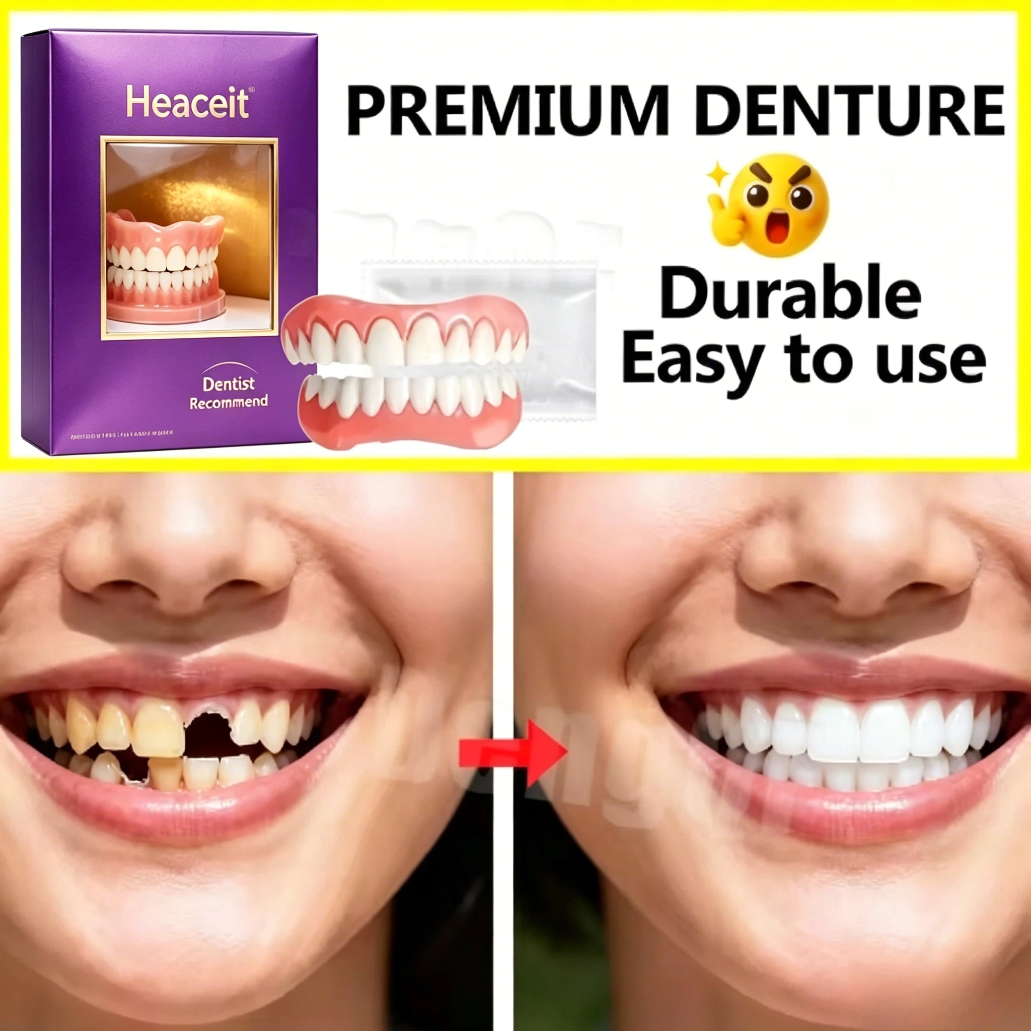 Silicone Cosmetic Dentures for Smile Enhancement - 3