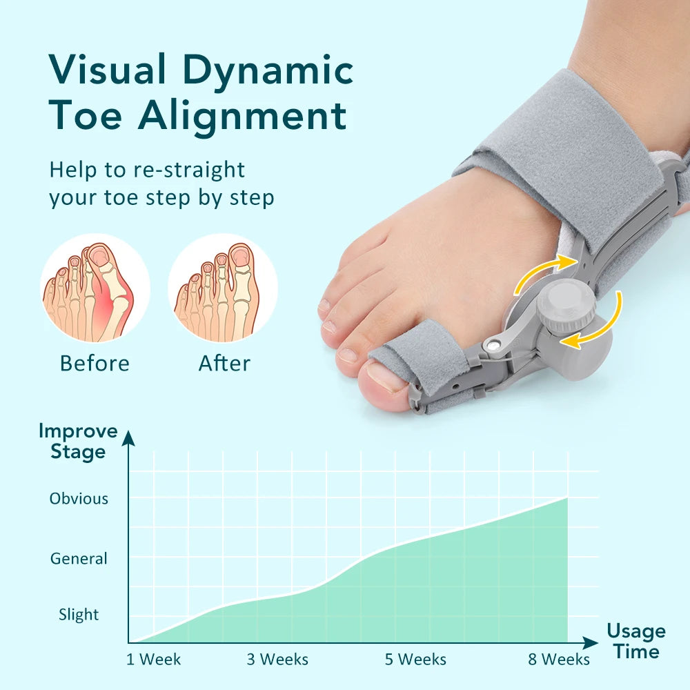 Adjustable Bunion Corrector for Hallux Valgus Support