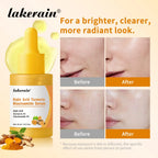 Brightening Kojic Acid and Turmeric Facial Serum