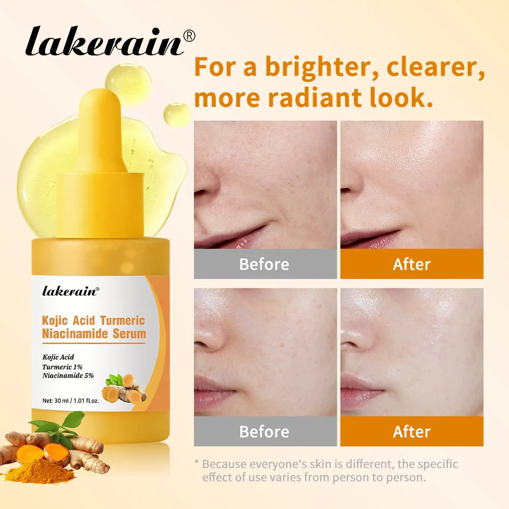 Brightening Kojic Acid and Turmeric Facial Serum