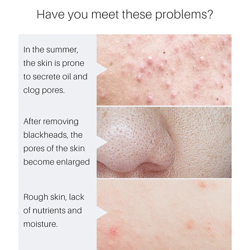 Pore Minimizing Facial Serum for Tightening and Smooth Skin - 7