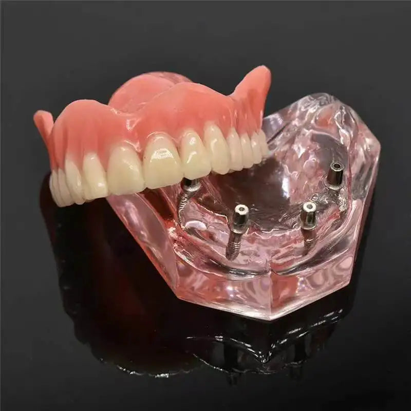 Cosmetic Upper and Lower Silicone Teeth Covers for Smile Confidence - 1