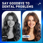 Soft Silicone Snap-On Dentures for Instant Realistic Smile