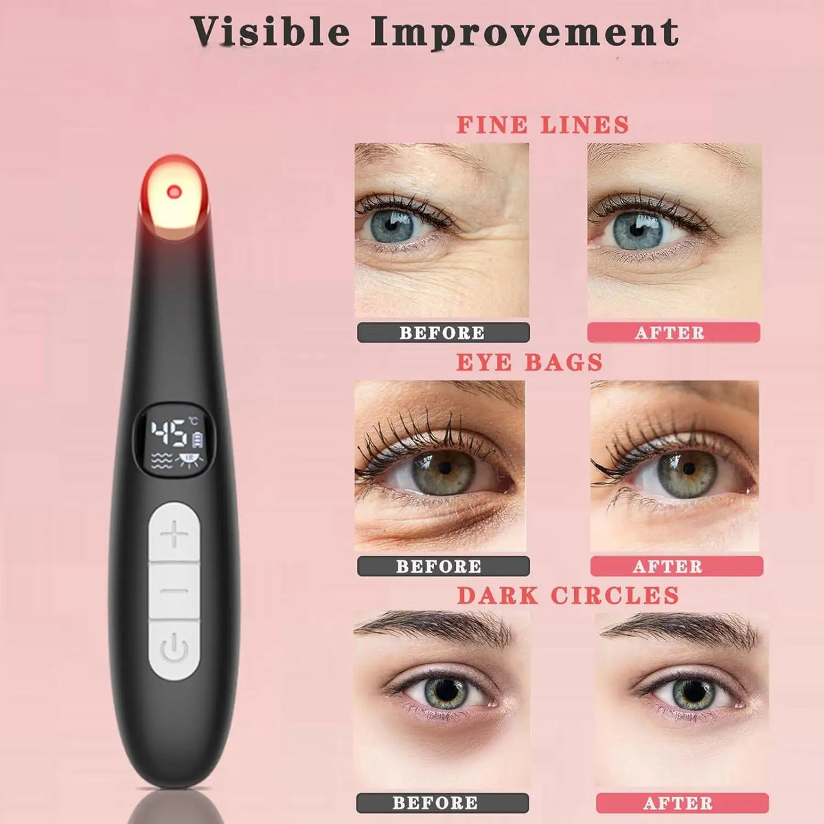 3-in-1 LED Vibration Eye and Face Lifting Wand
