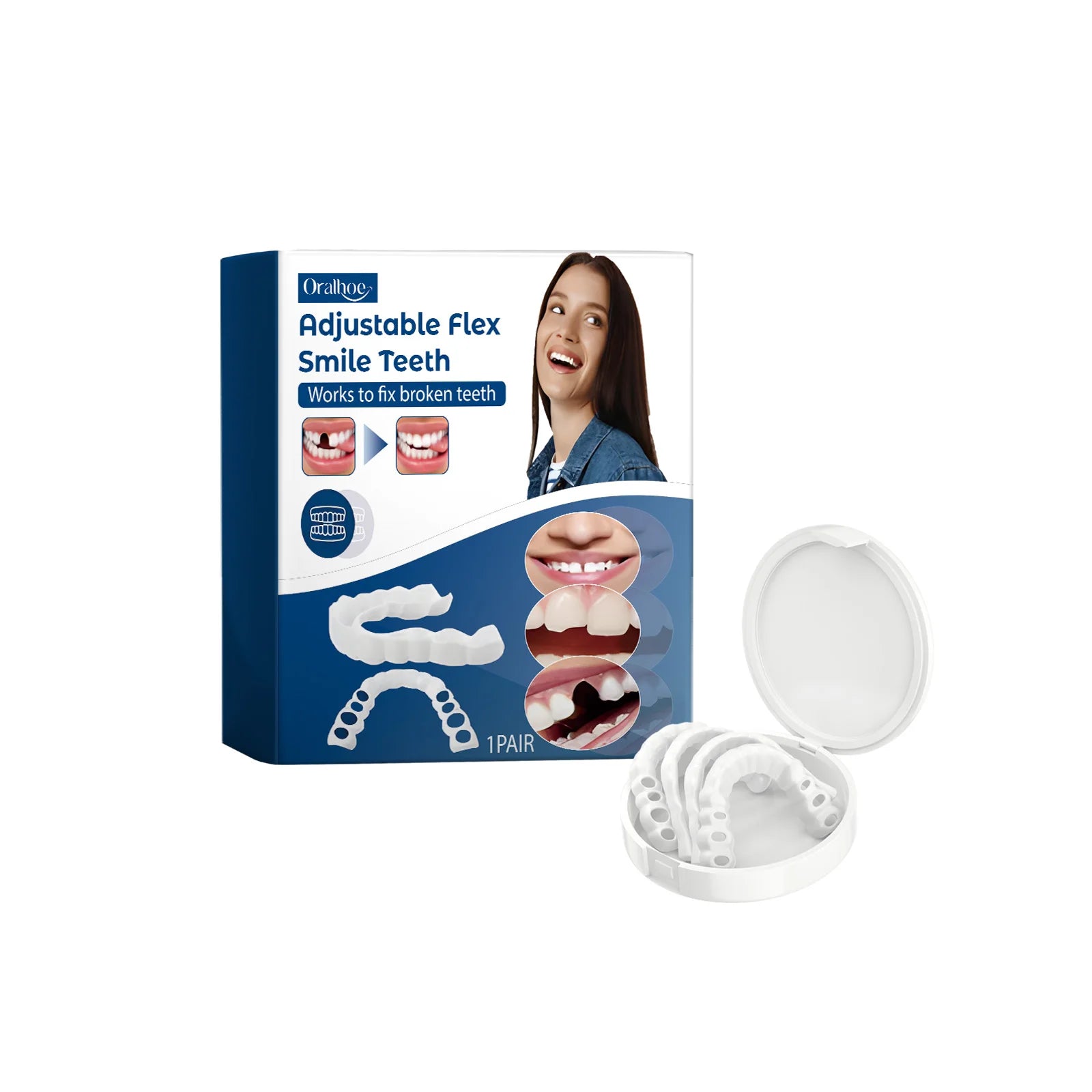 Adjustable Snap-On Dentures for Missing Teeth and Smile Correction - 21