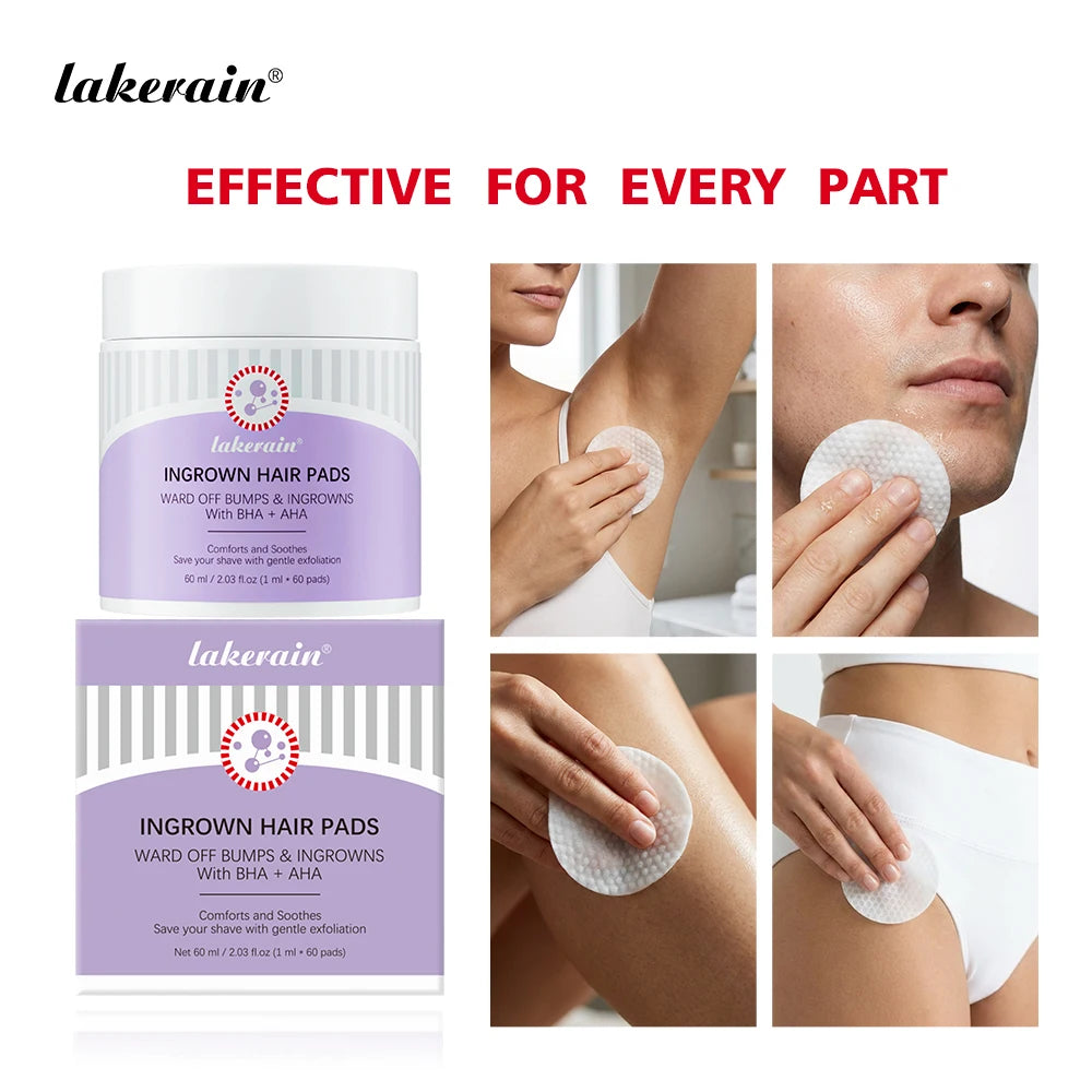 Ingrown Hair Treatment Pads for Razor Bumps and Exfoliation - 1