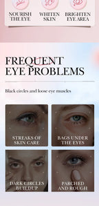 Anti-Wrinkle Retinol Eye Cream for Dark Circles and Puffiness