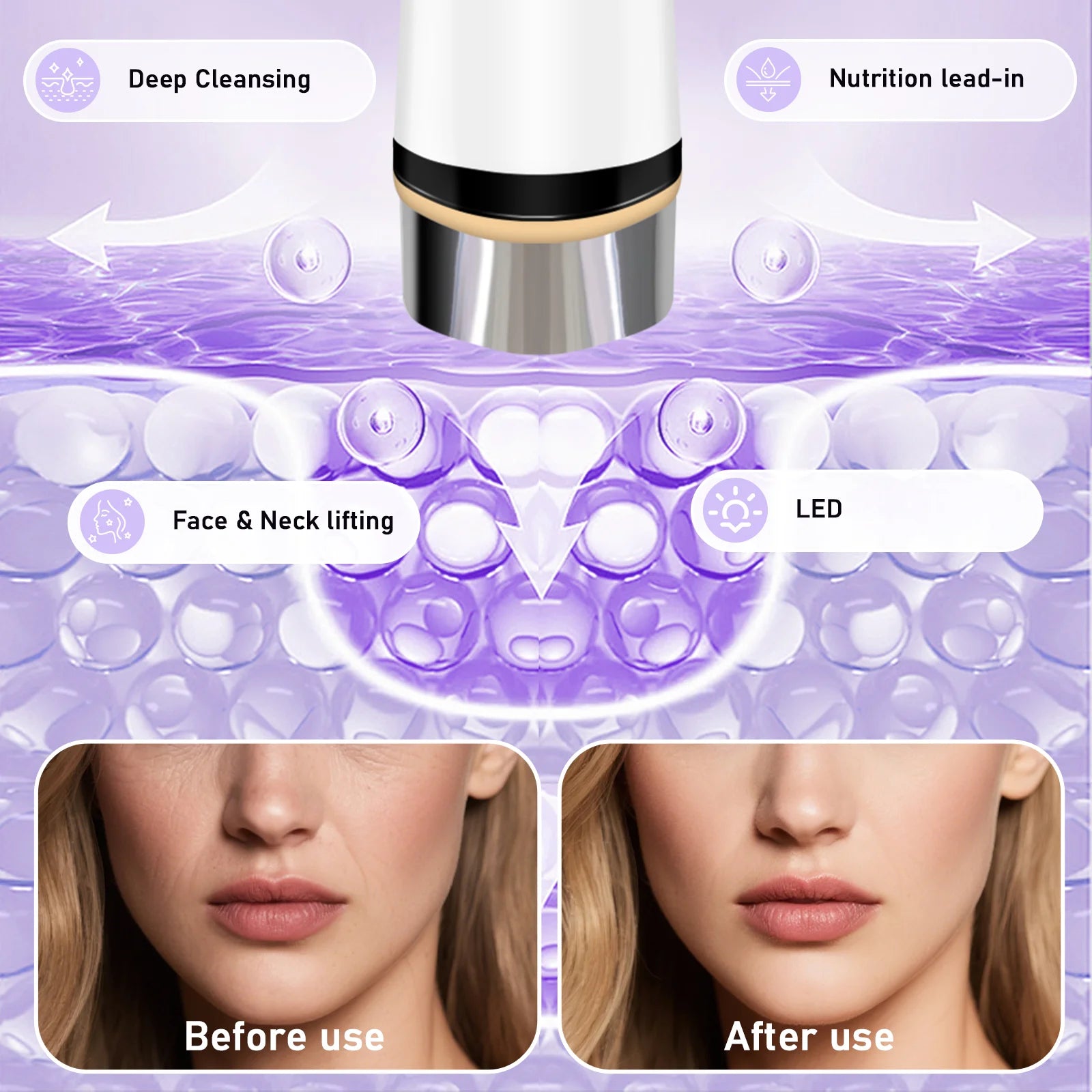 Microcurrent Facial Massager and Skin Tightening Device - 2