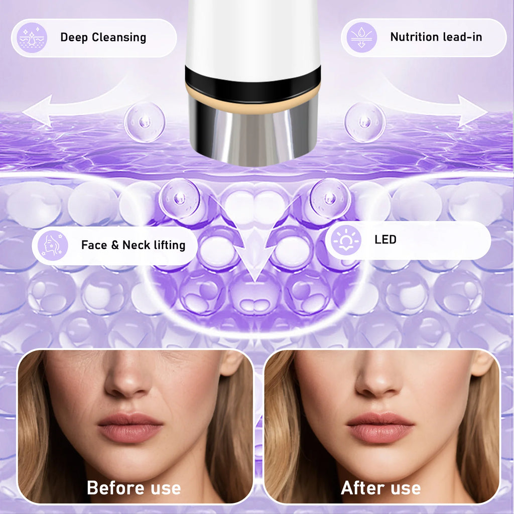Microcurrent Facial Massager and Skin Tightening Device