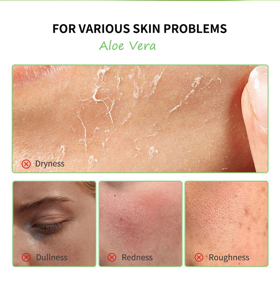Soothing Aloe Vera Moisturizing Gel for Face and Skin