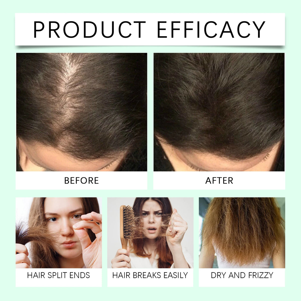 Rosemary Hair Growth Oil for Thinning Hair and Scalp Treatment