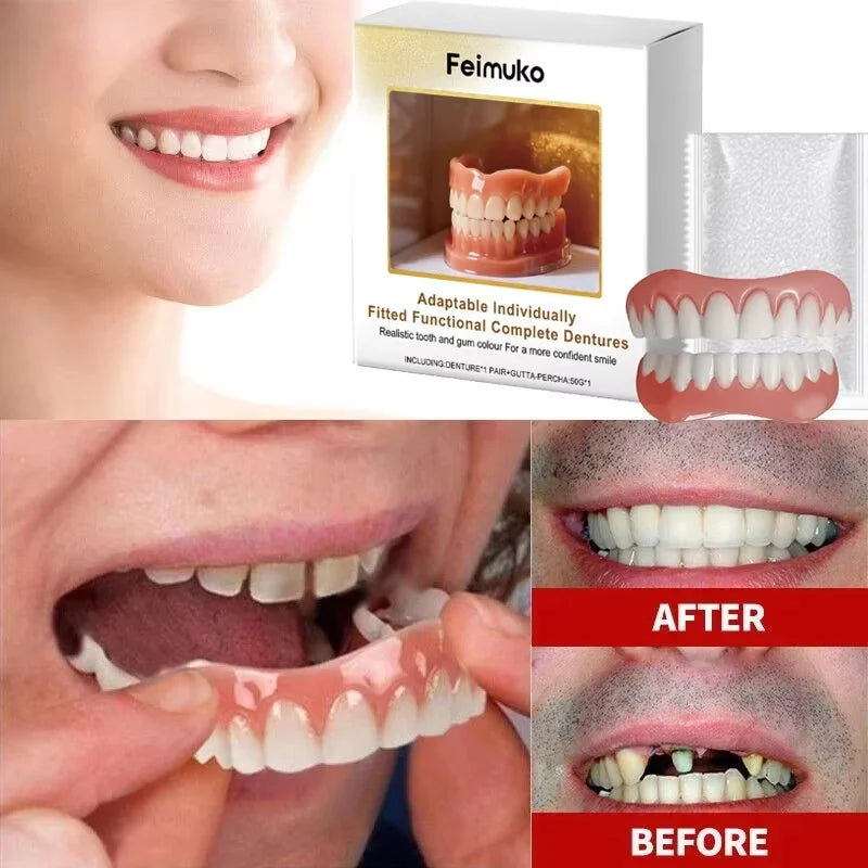 Custom Fit Cosmetic Denture Set for a Confident Smile - 2