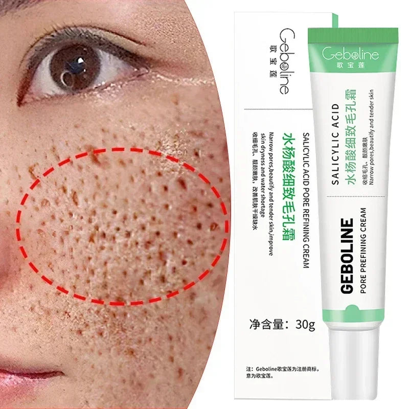 Salicylic Acid Pore Refining Cream for Acne and Blackheads - 6