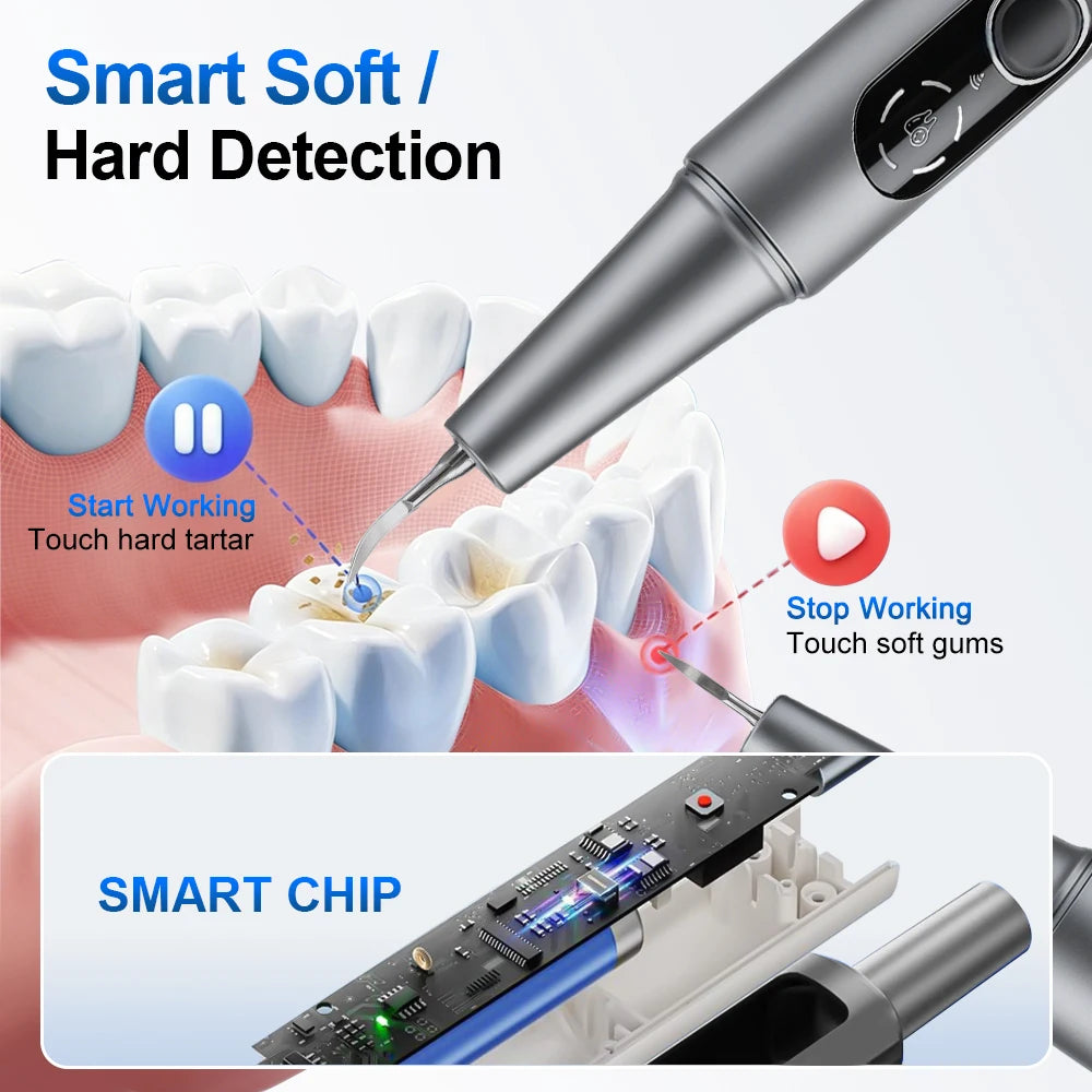 Visual Ultrasonic Dental Scaler with HD Camera for Plaque Removal - 5