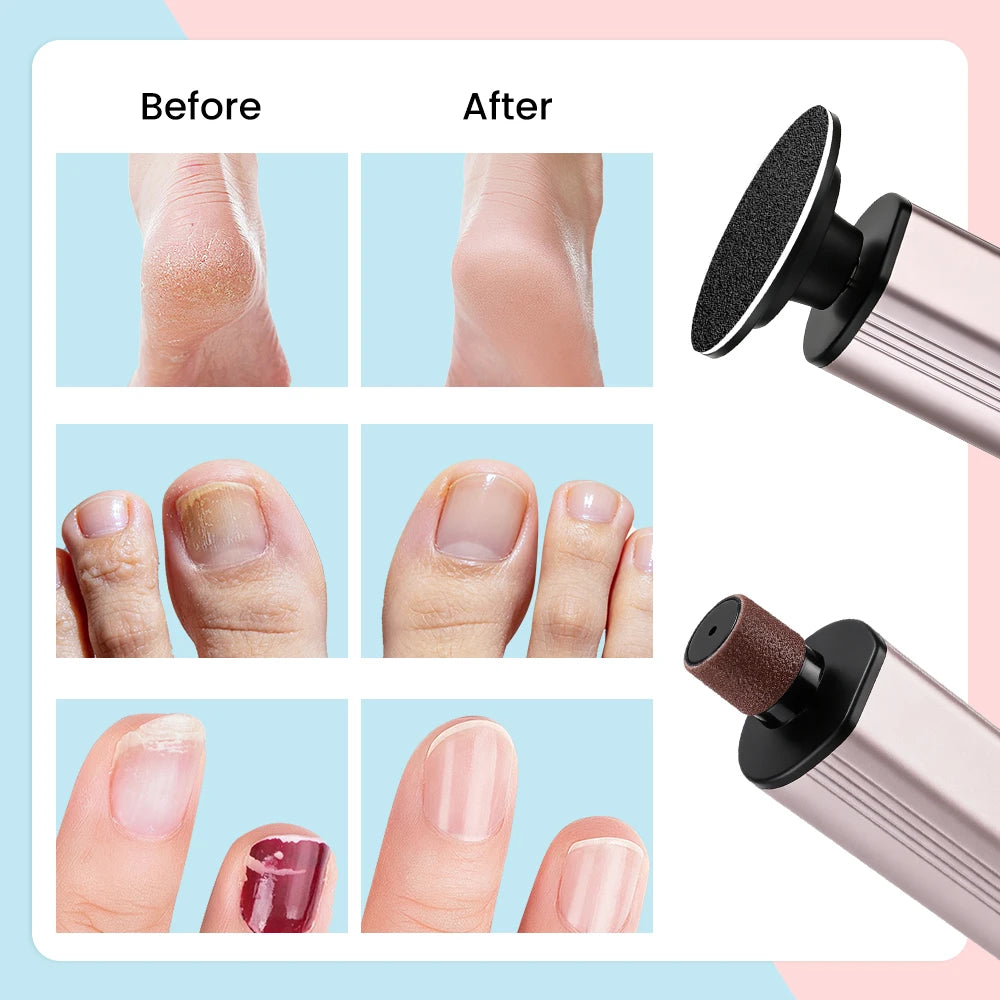 Electric Callus Remover and Pedicure Foot File