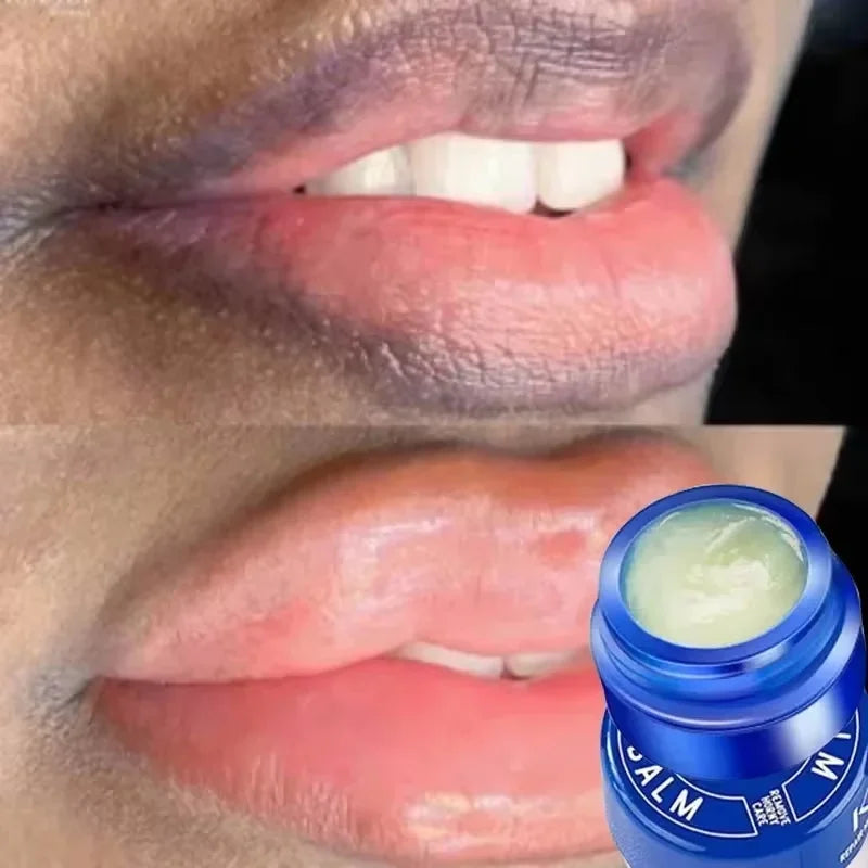 Moisturizing Lip Balm for Dark Spot Correction and Repair - 1
