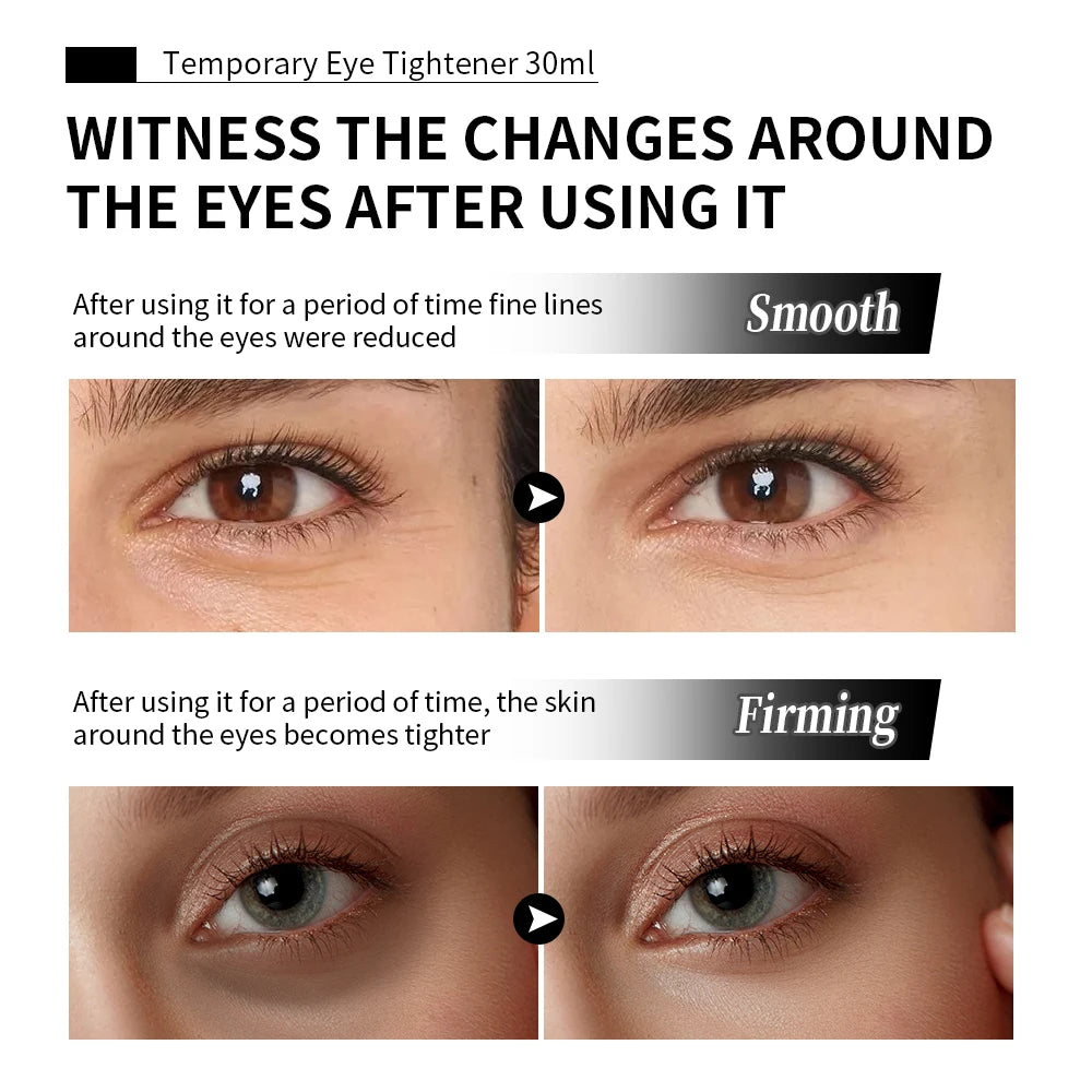 Temporary Eye Tightening Cream for Wrinkles and Puffiness - 5