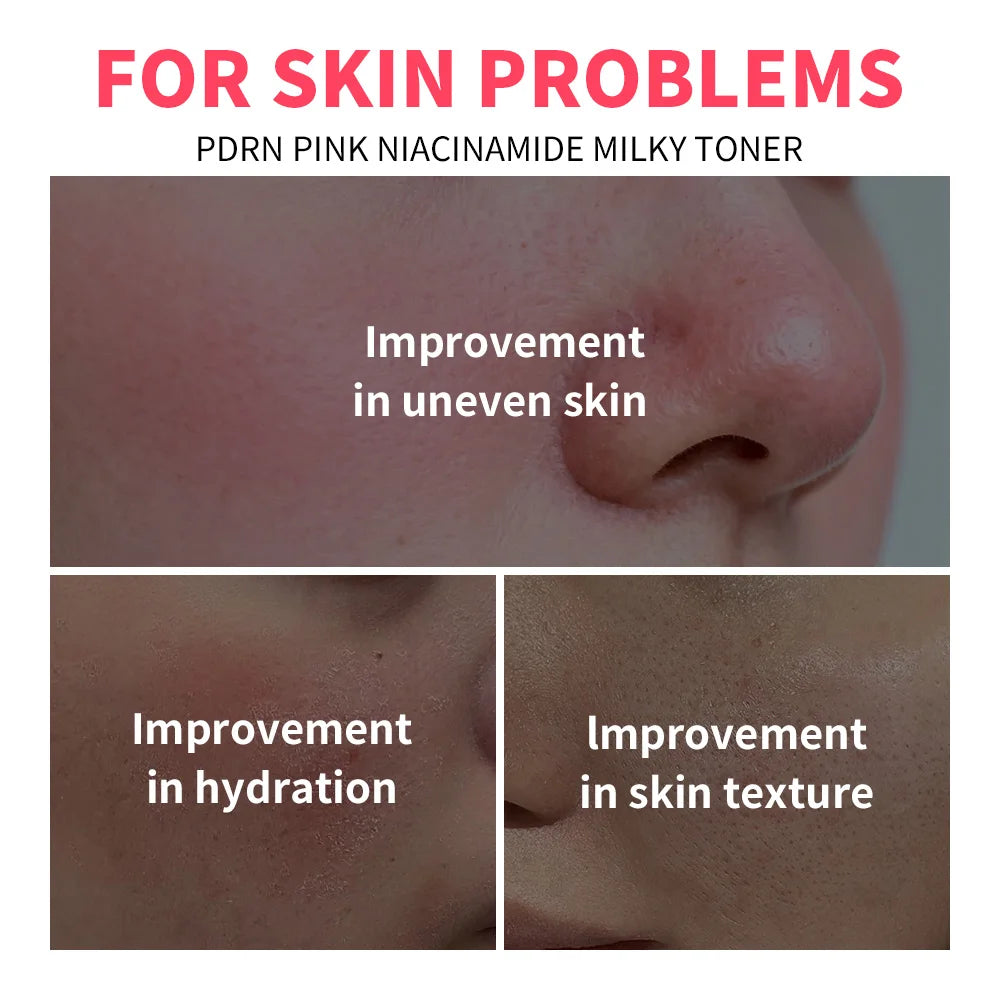 PDRN Niacinamide Milky Toner for Deep Hydration and Glow