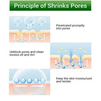 Salicylic Acid Pore Refining Cream for Acne and Blackheads