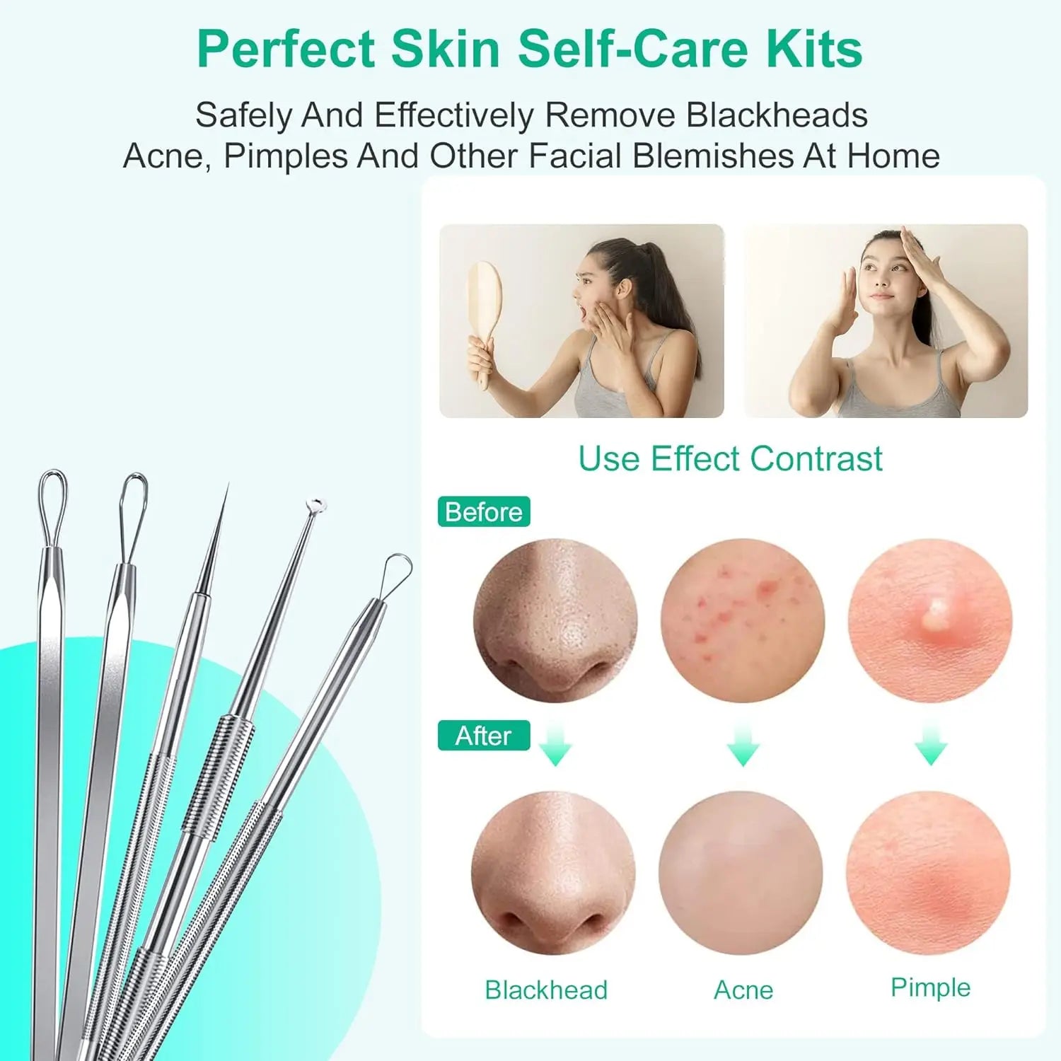 Stainless Steel Blackhead and Pimple Extractor Kit - 4