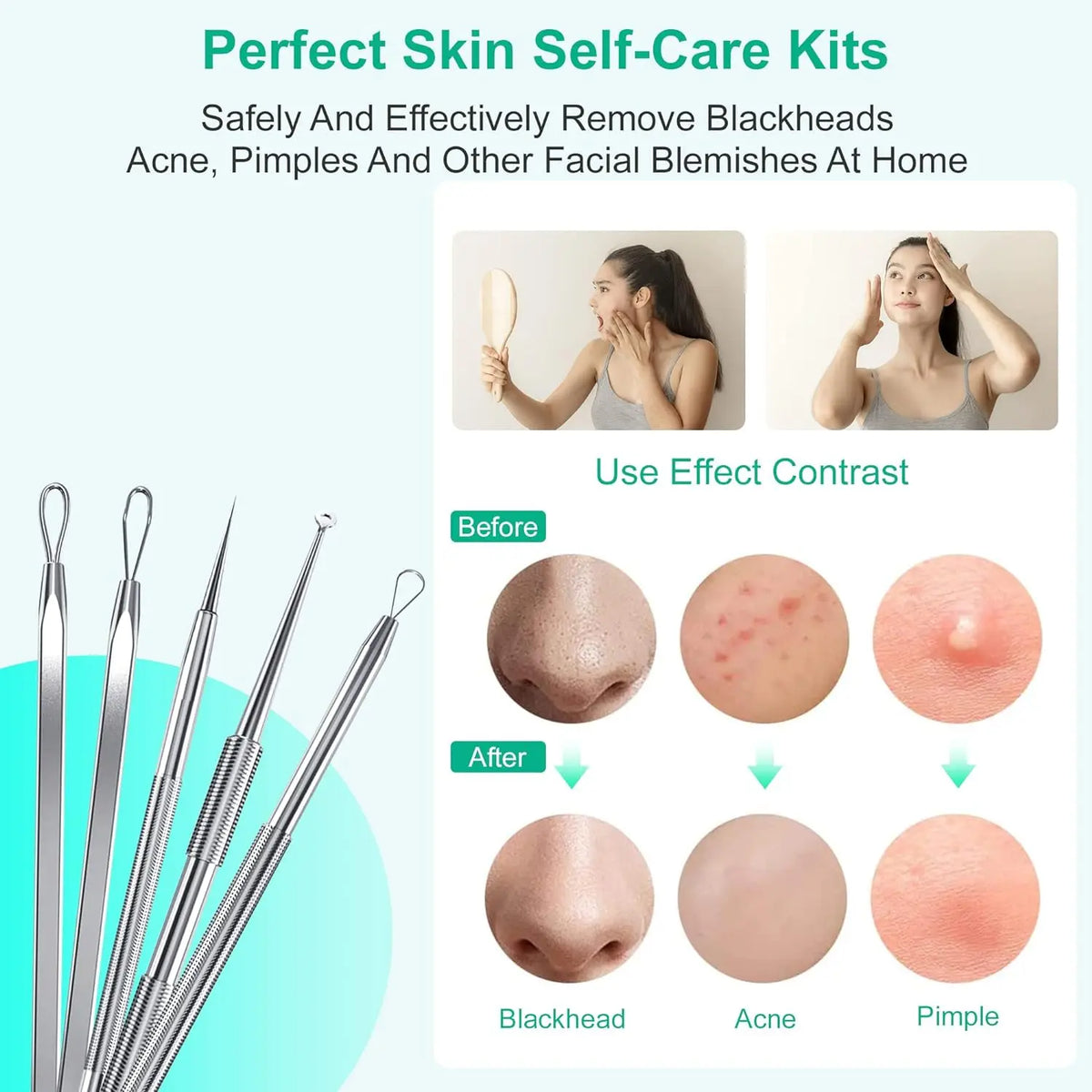 Stainless Steel Blackhead and Pimple Extractor Kit