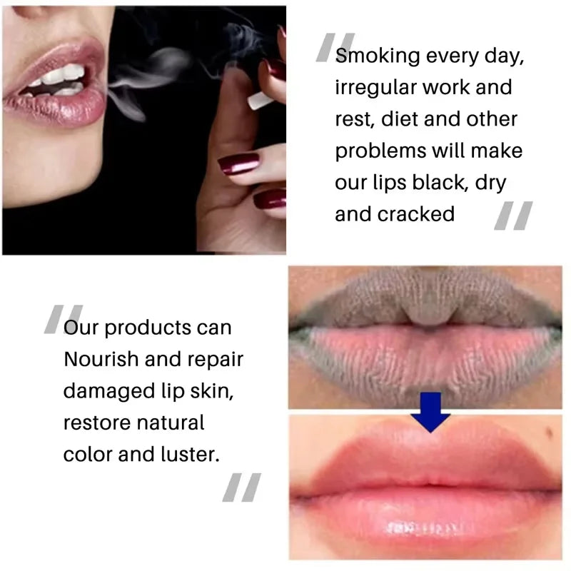 Moisturizing Lip Balm for Dark Spot Correction and Repair