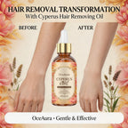 Cyperus Oil Hair Growth Inhibitor and Moisturizing Body Serum